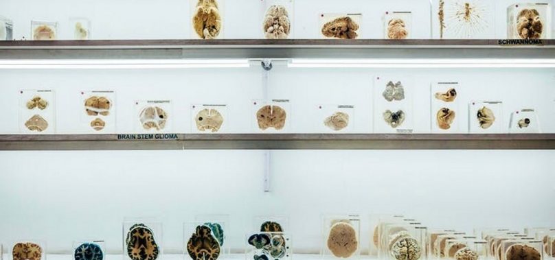 Bengaluru’s first Brain Museum is Now Open