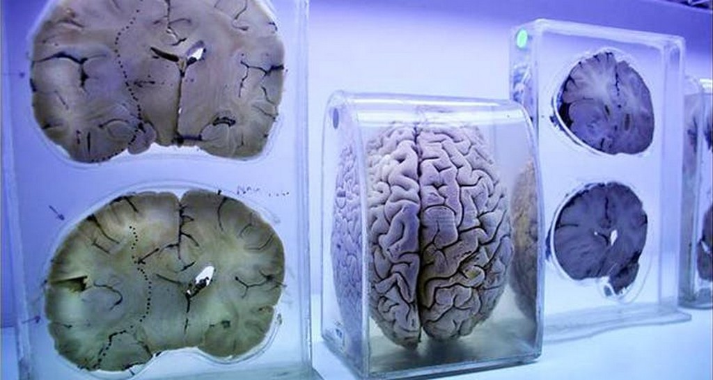 Bengaluru’s First Brain Museum 