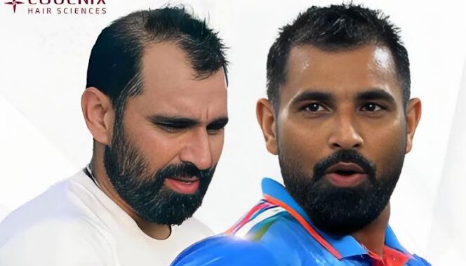 Mohammed Shami: A Stunning Transformation On and Off the Pitch