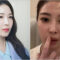 BoA breaks silence on plastic surgery buzz