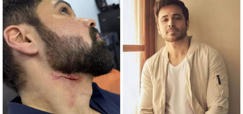 Emraan Hashmi injured on ‘Goodachari2’ set