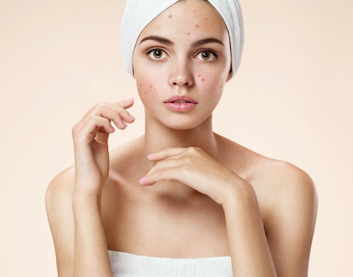 4 Things you should stop doing to your skin